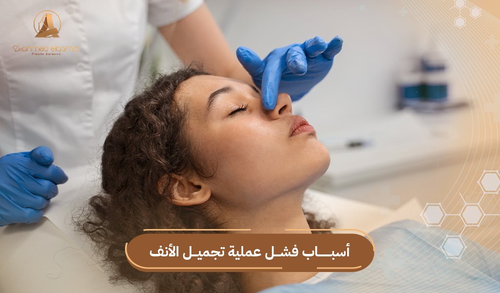 فشل عملية تجميل الانف