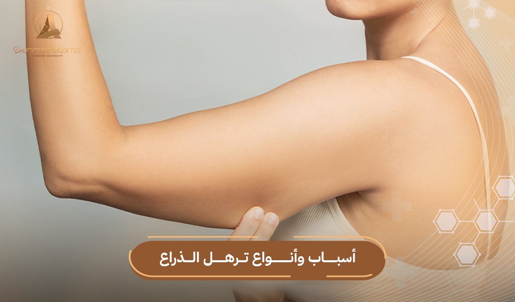 أنواع ترهل الذراع