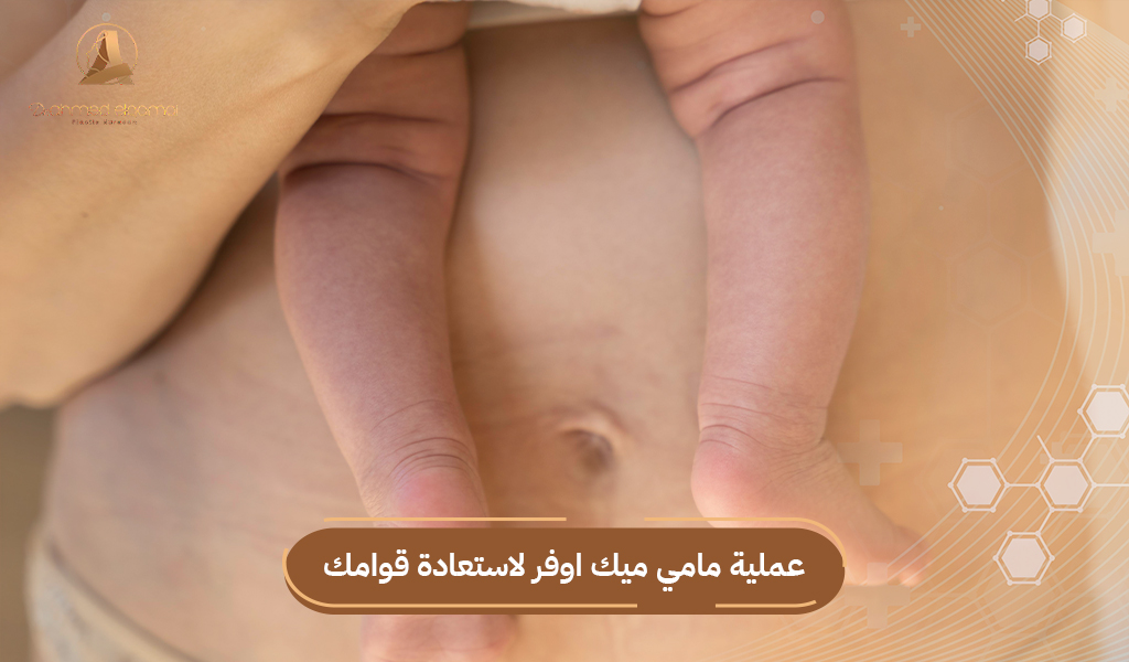 عملية مامي ميك اوفر