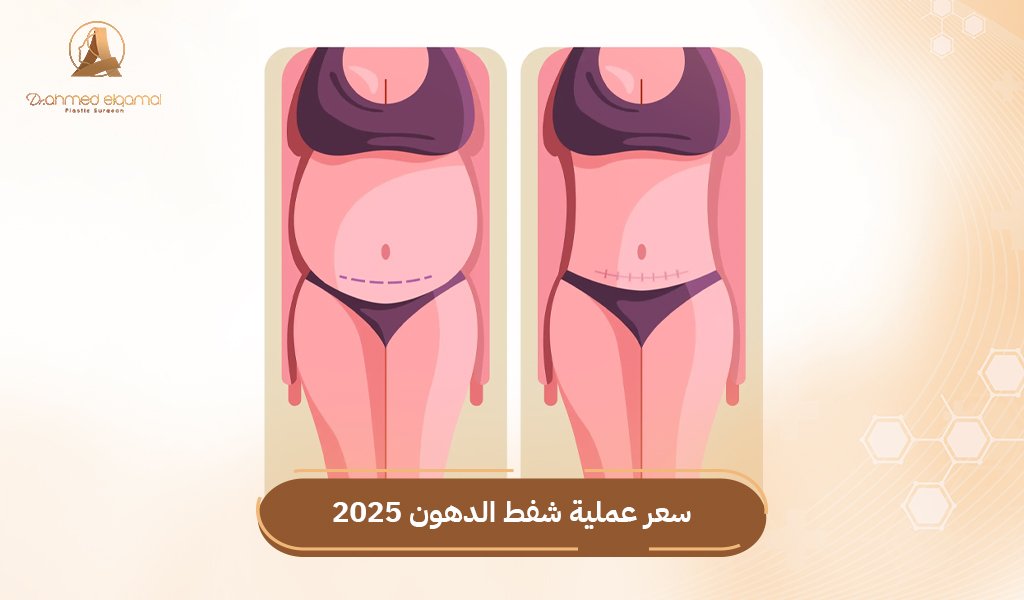 سعر عملية شفط الدهون