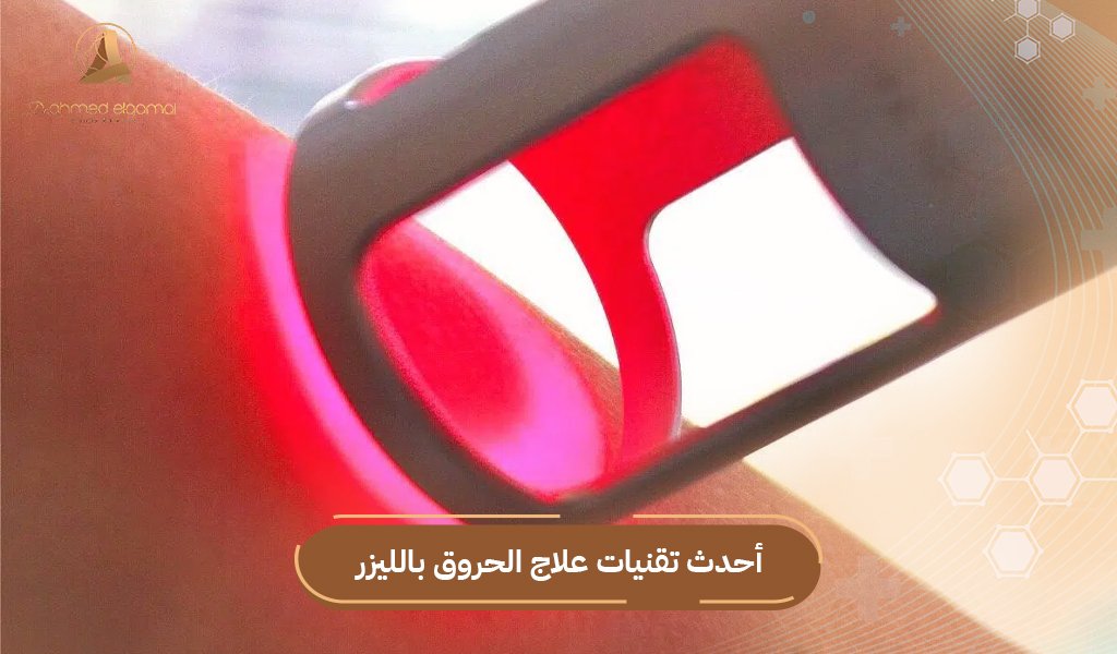 علاج الحروق بالليزر