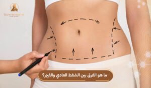 الفرق بين الشفط العادي والفيزر