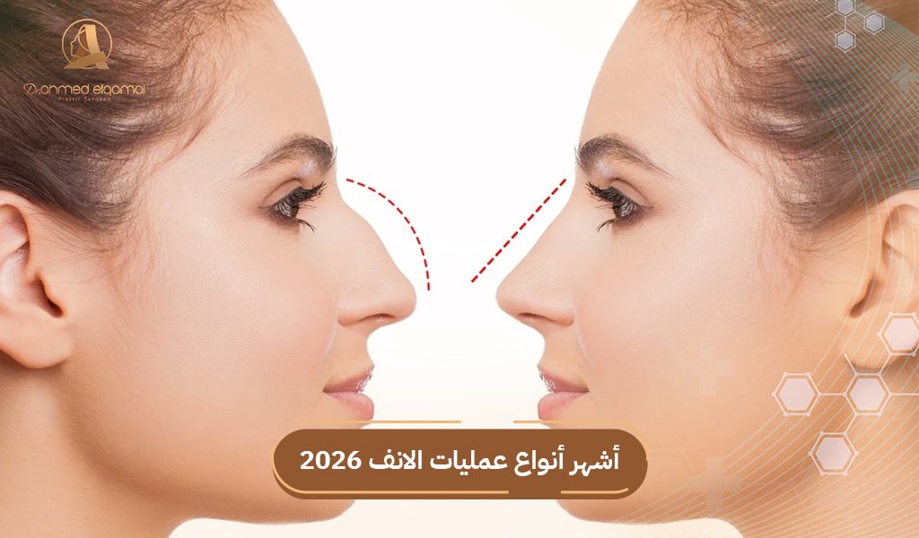 عمليات الانف