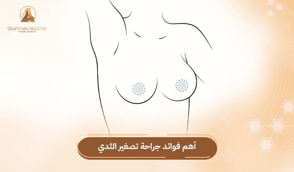 تصغير حجم الثدي