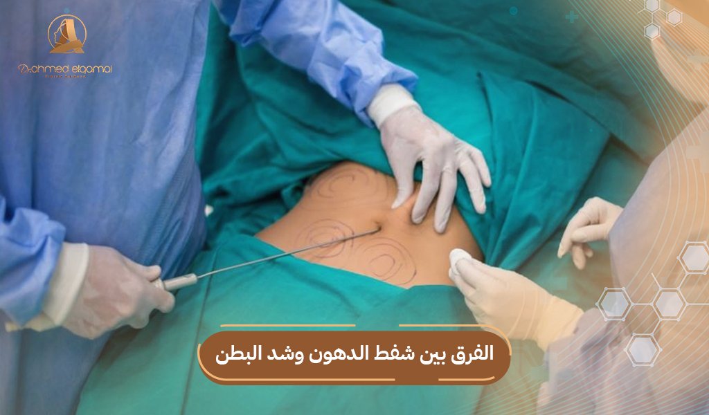 الفرق بين شفط الدهون وشد البطن