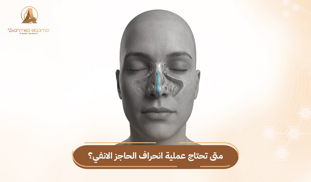 انحراف الحاجز الانفي
