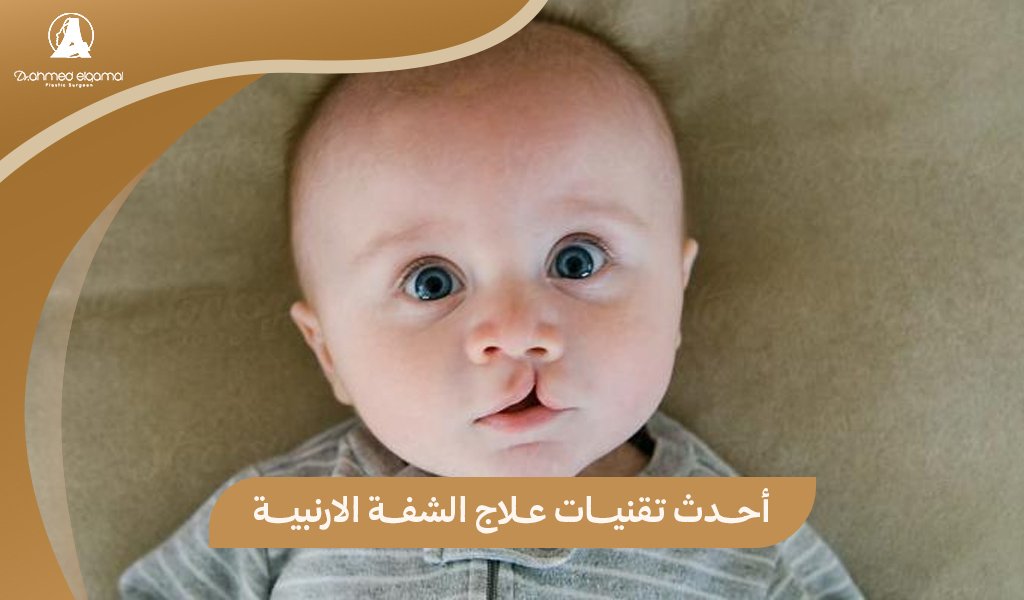 علاج الشفة الأرنبية