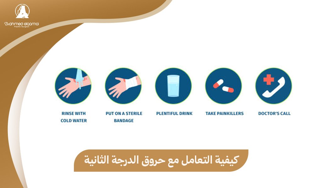 حروق الدرجة الثانية