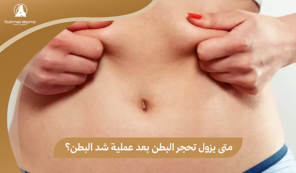 متى يزول تحجر البطن بعد عملية شد البطن